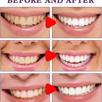 Crema dental Blanqueadora Purple Corrector Toothpaste